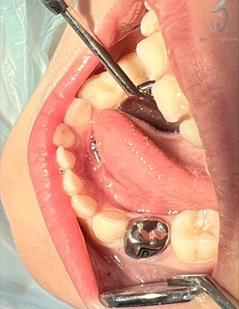 دندانپزشکی کودکان در رباط کریم
