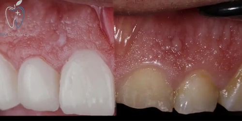 دندانپزشکی زیبایی در رباط کریم