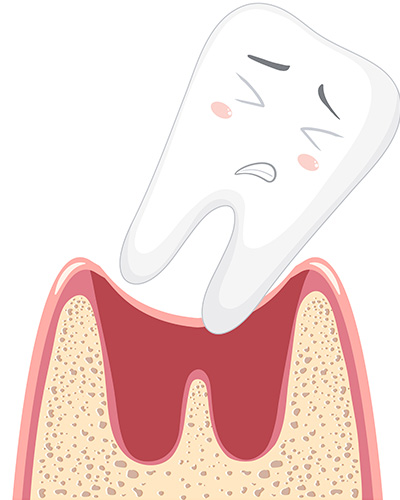 مراقبت های بعد از کشیدن دندان یا جراحی دندان